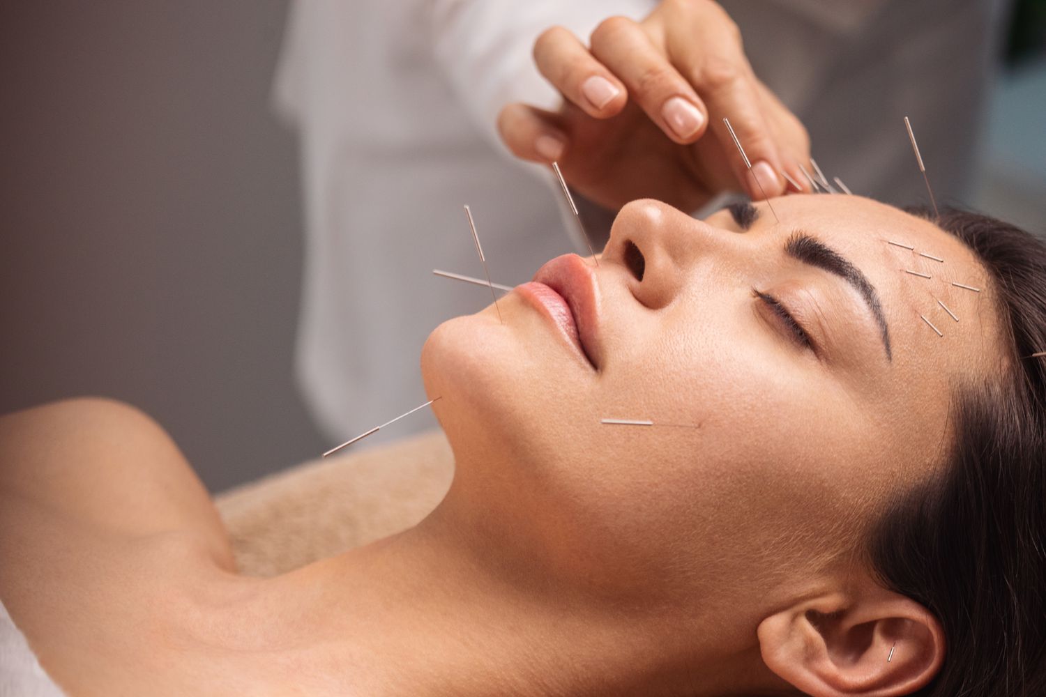 facial rejuvenation cosmetic acupuncture treat fine lines and wrinkles increase collagen production naturally
