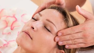 acupuncture for anxiety and depression
